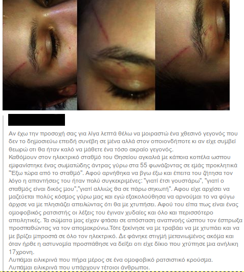 Θησείο : Ομοφοβική επίθεση σε 17χρονη το βράδυ στις 28/09