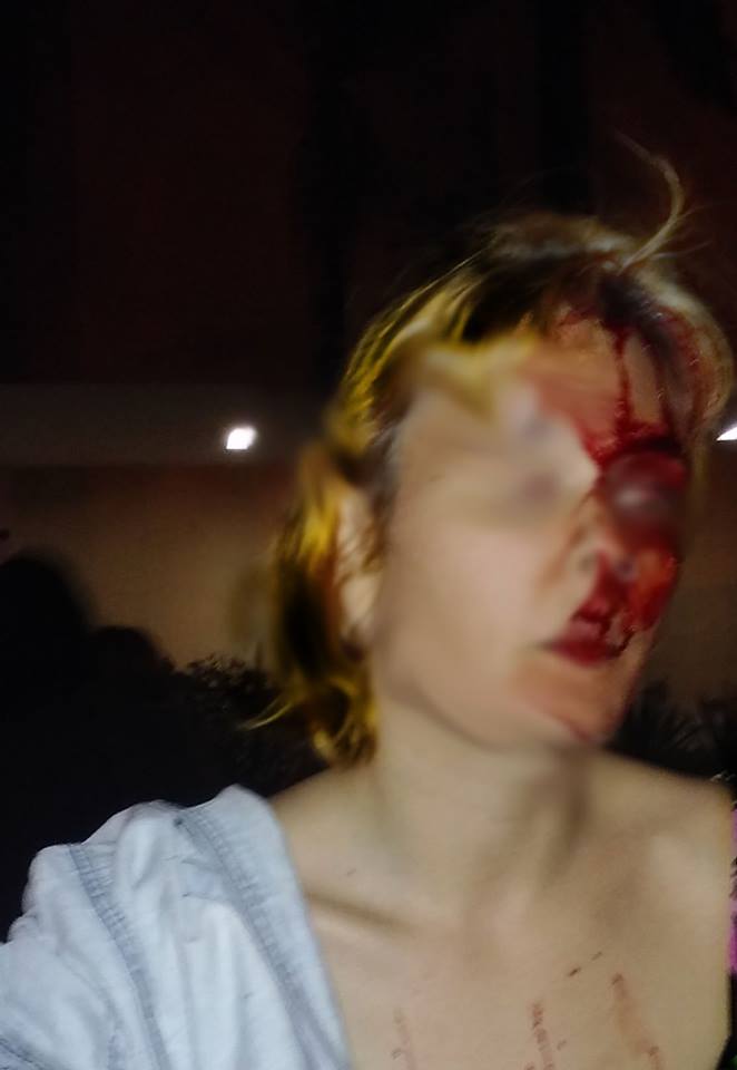 Βραζιλία : Επίθεση μπάτσων στην 1η Φεμινιστική και Αυτόνομη Γιορτή Βιβλίου στο Πόρτο Αλέγκρε